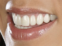 sourire