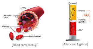 prp greffes osseuses