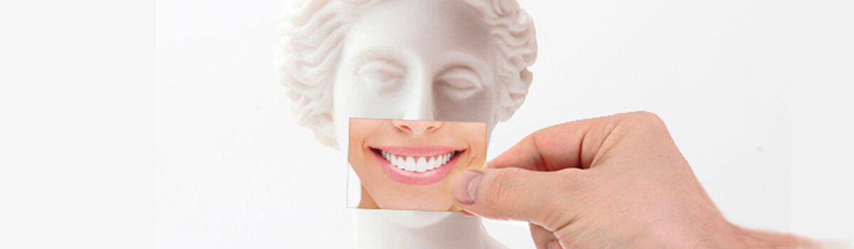 esthétique du sourire implant pour remplacer les incisives